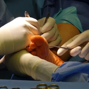 Orthopedic